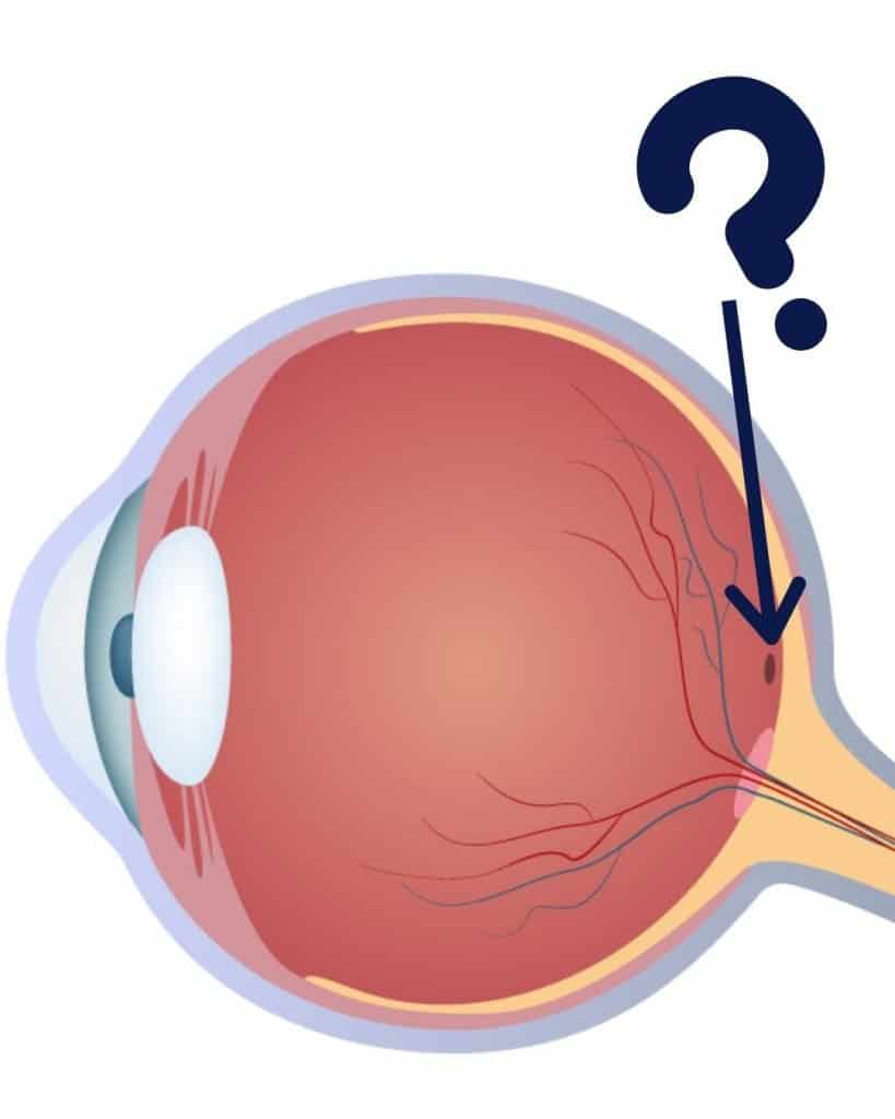 TEST-07-FOVEA.png
