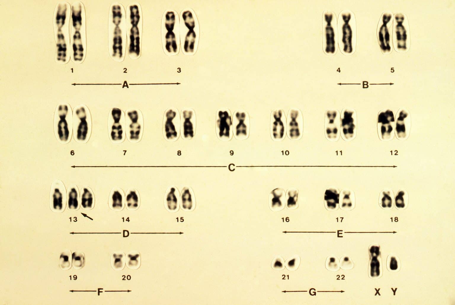 Карта х хромосомы человека